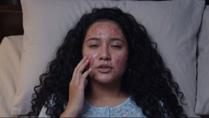 Wajah biduan nomor satu mendadak hancur melepuh part 5