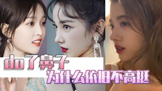 Do了鼻子为什么依旧不高挺？