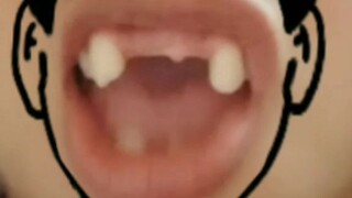 Teeth