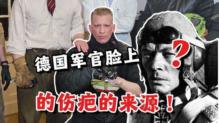 แผลเป็นของนายทหารเยอรมันเกิดจากการเข้าร่วมการแข่งขันแบบนี้!