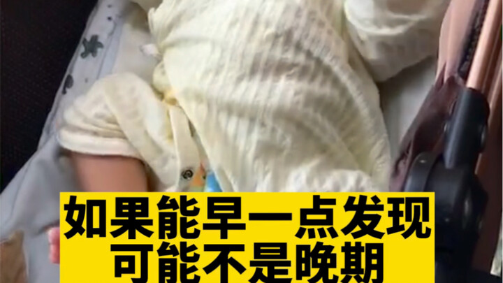 I always thought it was normal for babies to have slightly big bellies—just “froggy bellies.” It was