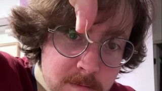 好小众的癖好：男子喜欢收集自己啃下来的指甲，6年过去已经装满一小瓶