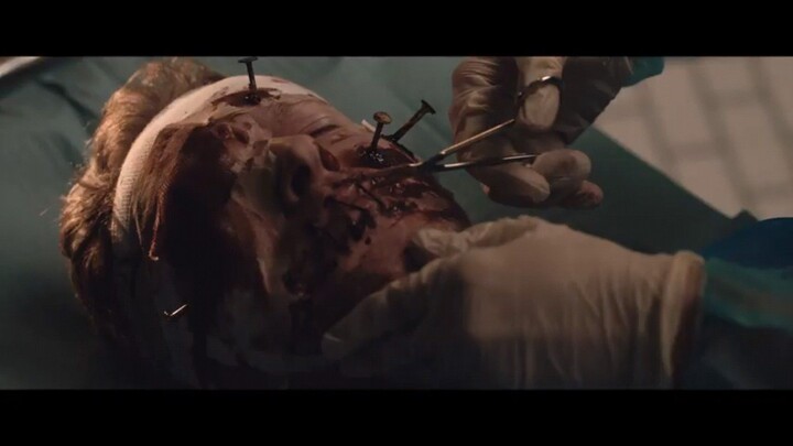 Surgery " Short horror Movies"