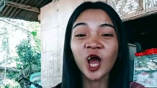 Akibat di cium aspal