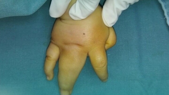 并指宝宝气的开始说话，大喊：“打你！打你！”