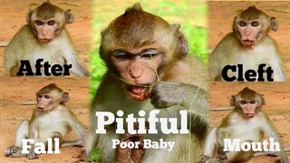 Pitiful Poor Baby Monkey Cleft Mouth After Fall Down, Poor Baby Monkey Injury Need Rescue Urgent