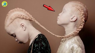 10 Đứa Trẻ Kỳ Lạ Và Khó Tin Nhất Hành Tinh Đang Tồn Tại Trên Đời I Vivu Thế Giới