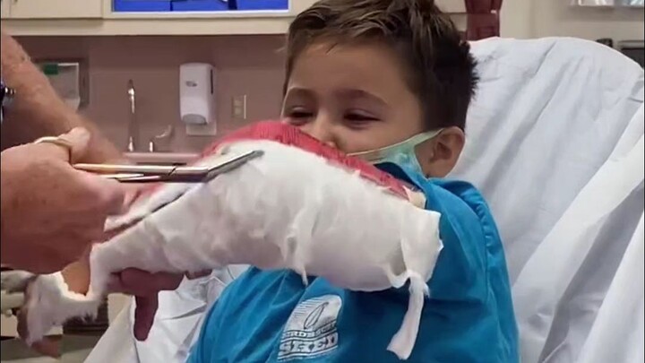 The injured little boy finally made it to the day when the plaster was removed, but when he saw the 