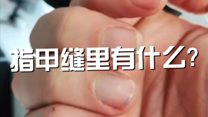 What’s in the cracks of your fingernails?