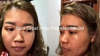 CARA AMPUH MENGATASI FLEK MEMBANDEL ‼️