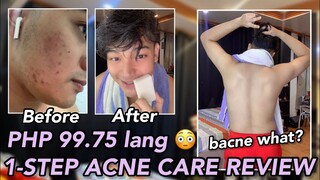 EFFECTIVE SOAP FOR BACNE & FACIAL PIMPLES | BELO ACNEPRO BAR REVIEW ✨