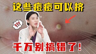 痘痘分不清，用再多药是也是白搭！