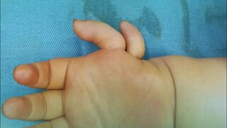 Mom: Move your finger gently, and the "floating thumb" will develop functionality from scratch.