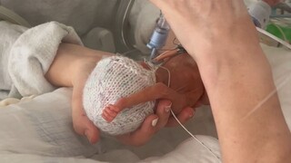 孕26周早产的婴儿有多小  体重只有0.5千克