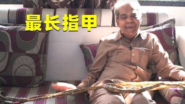 คุณลุงชาวอินเดียไม่ตัดเล็บมือซ้ายมา 66 ปี จนความยาวสร้างสถิติโลก แล้วทำไมถึงตัดเล็บในที่สุด?