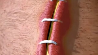 ปฏิกิริยาของร่างกายช่างน่าทึ่งเพียงใด?