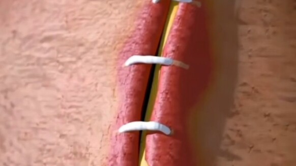 ما مدى روعة ردود فعل الجسم؟