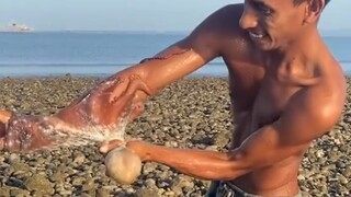 Lengan pria terlilit gurita, jika melihat benda ini sebaiknya jauhkan diri darinya