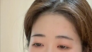Tại sao nhân trung lại ngứa?