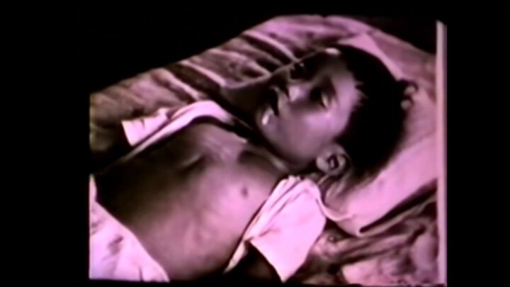 บันทึกญี่ปุ่นปี 1950 ของเด็กชายที่ถูกโรคพิษสุนัขบ้าโจมตี เสียงต้นฉบับ