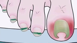 [Anime] The Pedicure