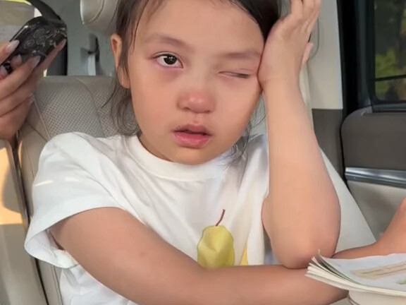 Gak nyangka, pas enggak bengkak malah lebih mirip…