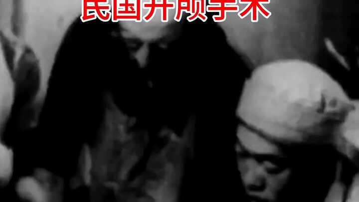 A Gold Bar Used in a Craniotomy During the * Era