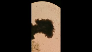 slime mold eating algae biofilm. time-lapse and real-time microscopy video compilation