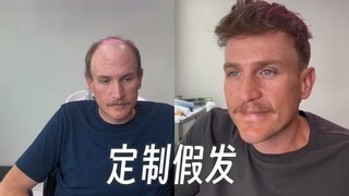 ขั้นตอนการสั่งทำวิกผมที่สะดวกสบายมาก แต่ละคนดูเปลี่ยนไปอย่างเห็นได้ชัด อดไม่ได้ที่จะยิ้มออกมาเลย