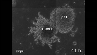 Asvide: Time-lapse video showing 4 days of sprout formation by HUVEC aggregate in fibrin…