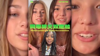 原来世界上是有「同母异父双胞胎」的‼️