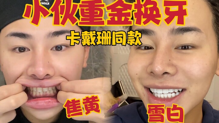 Are Influencers’ Teeth All Fake? A Tooth-Change Diary That Turns Your Chompers Snow-White in Seconds