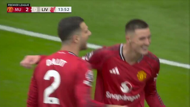 mu vs Liverpool