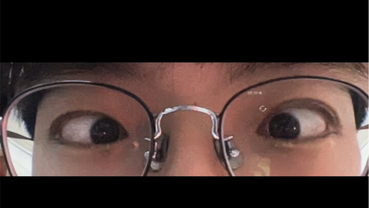 《三 眼 皮》，我的三眼皮是否有一些深情