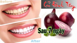 Teeth whitening with onions only 7 days | Làm trắng răng bằng hành tây | Làm Đẹp Từ Thiên Nhiên #24