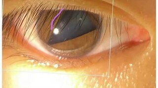 My pupils turned into triangles