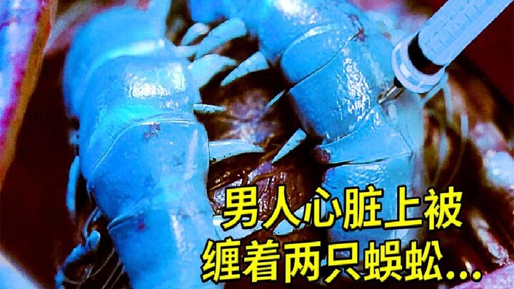 Seorang pria memiliki dua kelabang melingkar di jantungnya; untuk menyembuhkannya, hanya resep ini y