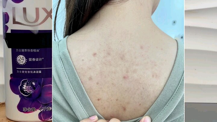 ชาเลนจ์ท้าทายให้ทำให้แบรนด์หนึ่งขุ่นเคืองทุกวัน วันนี้จะมาขุ่นเคือง “ครีมอาบน้ำ” กัน!