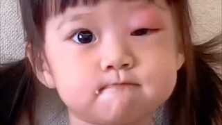 ربما يحب البعوض صغار البشر أيضًا! (البعوض اللعين)