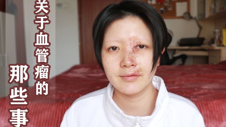 【Âm Thiếu】Ngày thứ 1000 trở thành UP chủ, muốn tâm sự về cuộc sống thường ngày với u máu