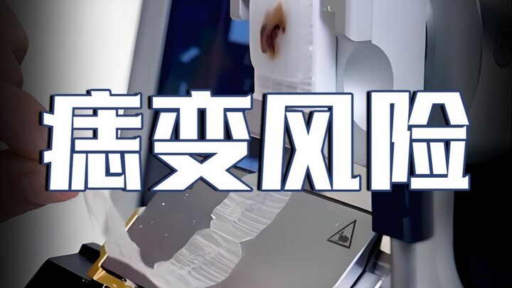 Apakah tahi lalat di tubuh bisa berubah menjadi kanker?