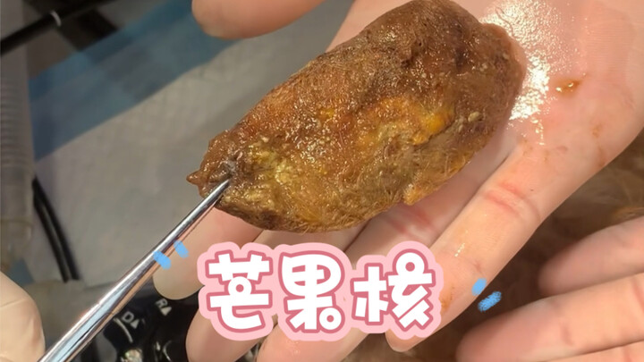 The dog rummaged through the trash and accidentally ate a mango seed. Luckily, it was taken to the h