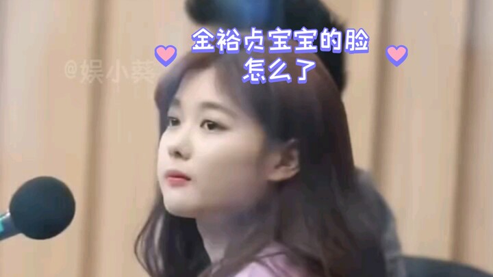 หน้าของน้องคิมยูจองเป็นอะไรไปคะ