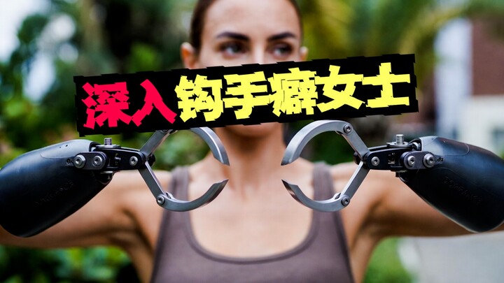 【Cinta dengan Kait】Pria meminta kekasihnya menjalani amputasi lalu memasang kaki palsu berbentuk kai