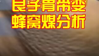 การวิเคราะห์เลือดในอุจจาระของเหลียงจื่อ และการวิเคราะห์ภาพถ่ายกระเพาะอาหารของเหลียงจื่อที่มีลักษณะคล