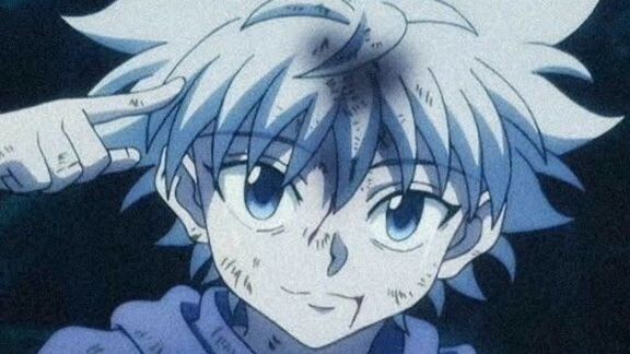 Killua ๐ฅบ