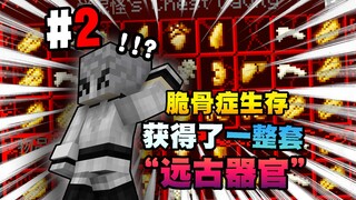 [Living with Osteogenesis Imperfecta] I've Obtained an Entire Set of "Ancient Organs"!!? Episode 2