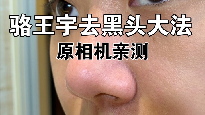 لا أصدق ذلك! كل الرؤوس السوداء التي ظلّت لسنوات اختفت تمامًا! تعال وجرّب متعة الأنف الحليبي!