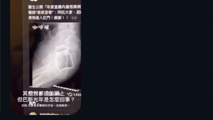 หมอระบบทางเดินอาหารและทวารหนักเผย: ไต้หวันก็มีผู้เชี่ยวชาญฝีมือเยี่ยมไม่น้อยเลยนะ!