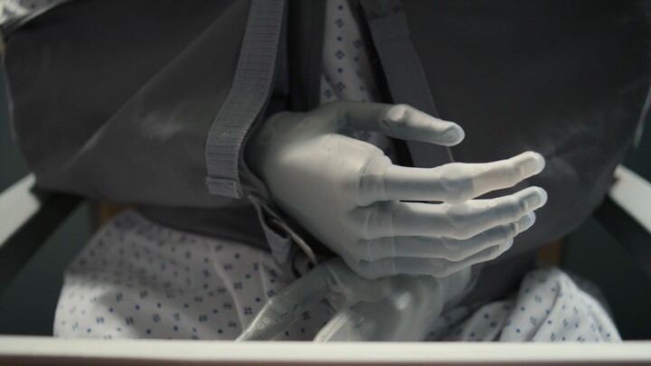 [The Good Doctor] Titanium Alloy Bionic Prosthetics: A Perfect Fusion of Futuristic Technology and M